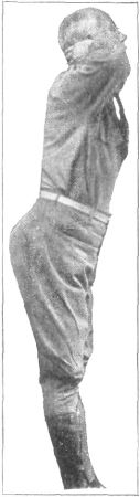 Fig. 6&mdash;INCORRECT POSITION OF SHOULDERS IN NECK FIRM