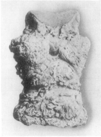 Fig. 17&mdash;Phalangeal exostoses.