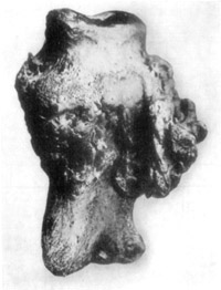 Fig. 19&mdash;Phalangeal exostoses in chronic ringbone. Museum
specimen of the Kansas City Veterinary College.