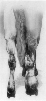 Fig. 62&mdash;Elephantiasis.