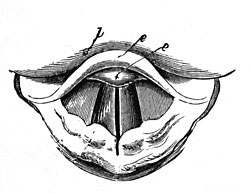 FIG. 193.&mdash;The vibration of the vocal cords produces
the sound of the human voice.