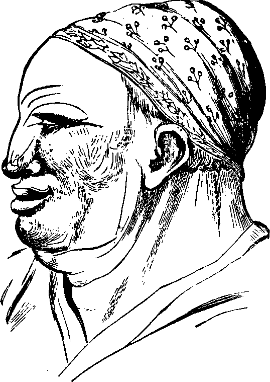 Illustration:
Fig. 87.