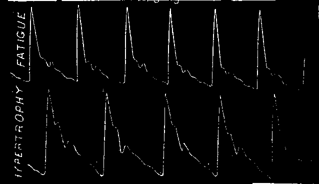 Illustration:
Fig. 3.