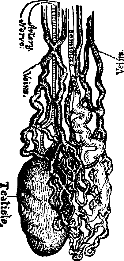 Illustration:
Fig. 3. Well developed Varicocele.