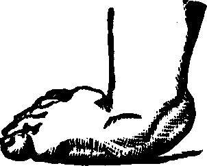 Illustration:
Fig. 20.