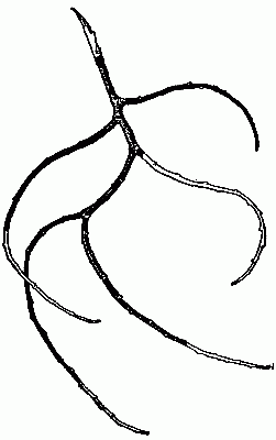 Fig. 136&mdash;The black bands on the twigs show where they should be trimmed off.