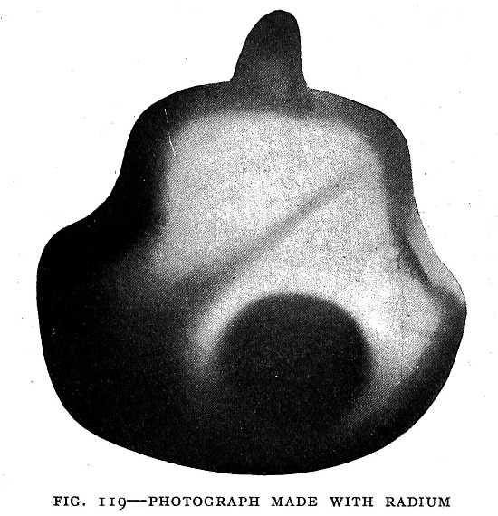 FIG. 119&ndash;PHOTOGRAPH MADE WITH RADIUM