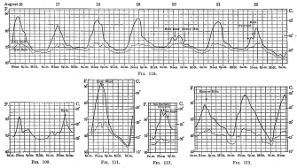 Figs. 109-113&mdash;Temperature curves for locations in the
montaña, July and August, 1911. The curves are based on hourly readings
with interpolated readings for such critical occurrences as the
appearance of cloud or rain. Dry bulb readings are shown by solid lines,
wet bulb by dotted lines, and breaks in the continuity of the
observations by heavy broken lines. Fig. 109 is for Pongo de Mainique,
August 20 and 21; Fig. 110 for Yavero; Fig. 111 for Santo Anato, August
11 and 12; Fig. 112 for Sahuayaco, August 20, and Fig. 113 for Santa
Ana, July 30 to August 1.
