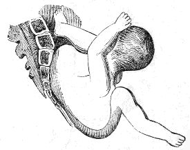 Trunk
presentation