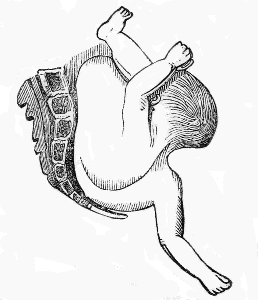 left
cephalo iliac position
