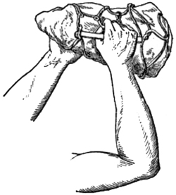 Fig. 11.